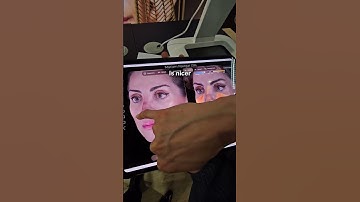 This AI Helps Doctors Show Results!