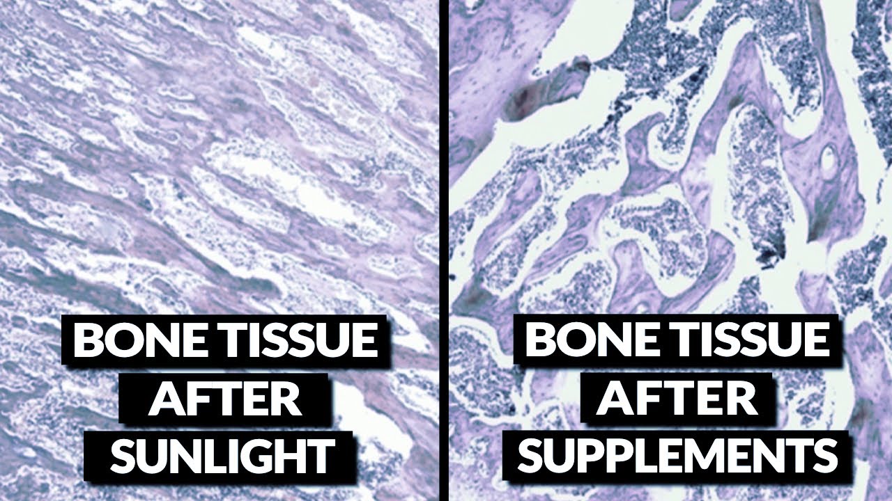 Исследование доказывает, что солнечный свет НАМНОГО полезнее для костей, чем добавки с витамином D.