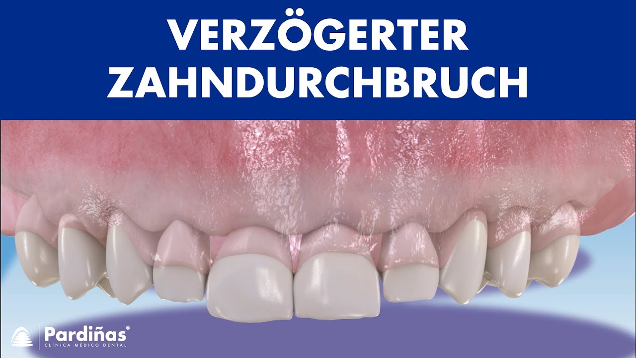 Zahneinschuss Zahndurchbruch Wie Sieht Das Aus www.youtube.com