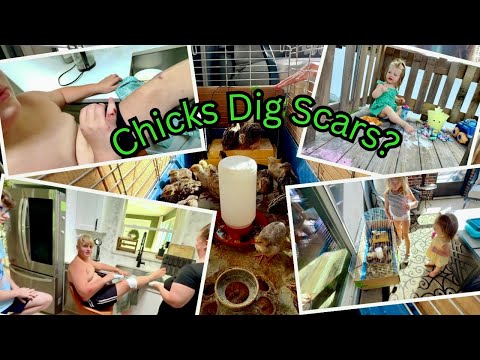 Do Chicks Dig Scars?