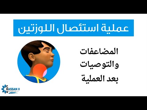 عملية استئصال اللوزتين: المضاعفات والتوصيات بعد العملية