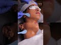 True Zero Laser Hair Removal Chennai &amp; Coimbatore | Tune Clinical Aesthetics - Smooth Skin Results