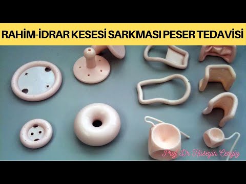 Video: Peser Nasıl Eklenir (Resimlerle)