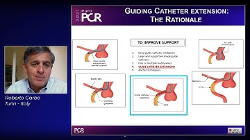 Overcoming the tortuosity in complex PCI - EuroPCR 2021