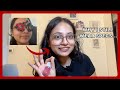 I got Lasik eye surgery and here's WHAT happened...