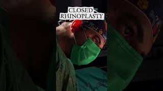 Closed Rhinoplasty by Op. Dr. Erkin Önsal