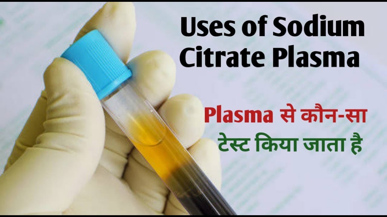 sodium citrate plasma I what is sodium citrate I Tanu Path - YouTube