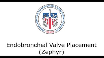 FINAL Zephyr Valve with Captions