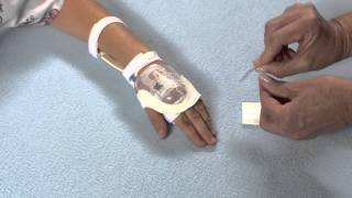 Use of I.V. House UltraDressing 730 Series with Pediatric Patients; Hand or Arm