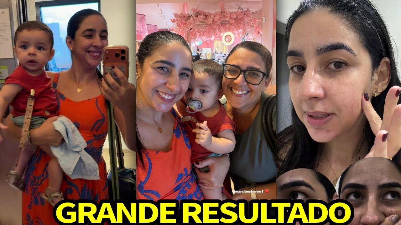 DANI OLIVEIRA MOSTRA GRANDE RESULTADO DO TRATAMENTO DE MELASMA 