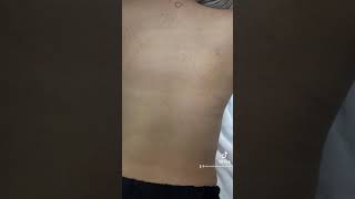 Purifying Back Facial