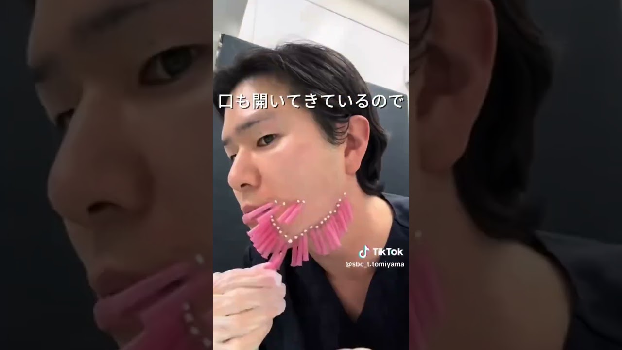 自分でやってみたシリーズ3#うるおい #美容針 #コラーゲン #プチ整形 #セルフケア #shorts