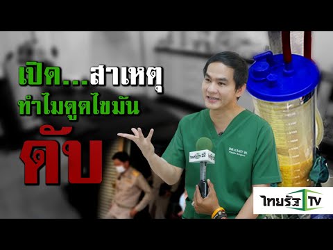 วีดีโอ: เผยความลับแล้ว! David Manuyan ทำการดูดไขมันที่คลินิก