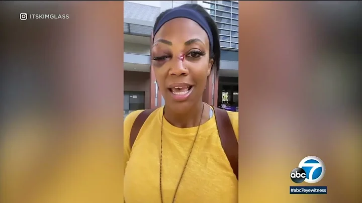 Kim Glass, former Olympic volleyball player, says ...