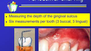 Charting Sequence and Periodontal Charting