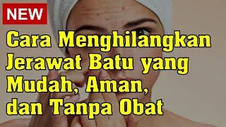 Jenis Jerawat dan Cara Mengatasinya | Skincare101