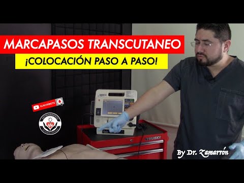 MARCAPASO TRANSCUTÁNEO: ¡COLOCACIÓN PASO A PASO! BY DR. ZAMARRÓN (PORQUE USTEDES LO PIDIERON)