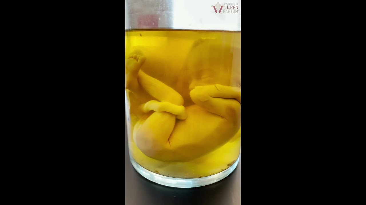 Amazing REAL Human Fetus That Taught Millions Shorts