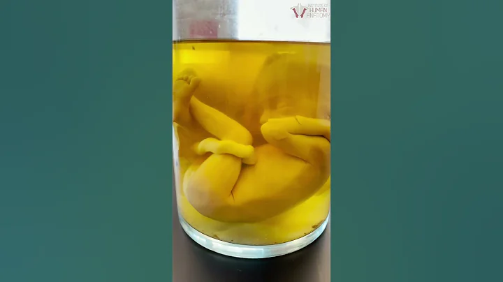 Amazing REAL Human Fetus That Taught Millions | #shorts - DayDayNews