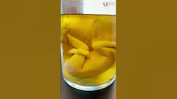 Amazing REAL Human Fetus That Taught Millions Shorts 
