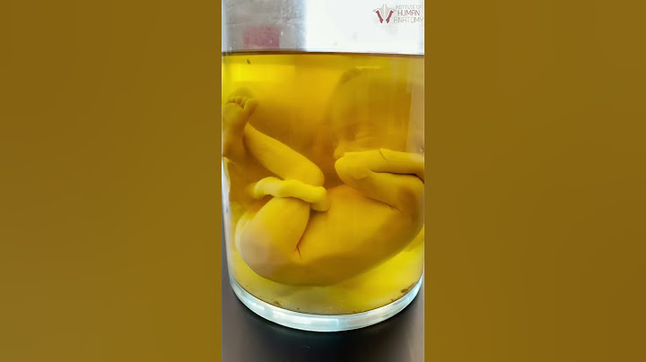 Amazing REAL Human Fetus That Taught Millions | #shorts