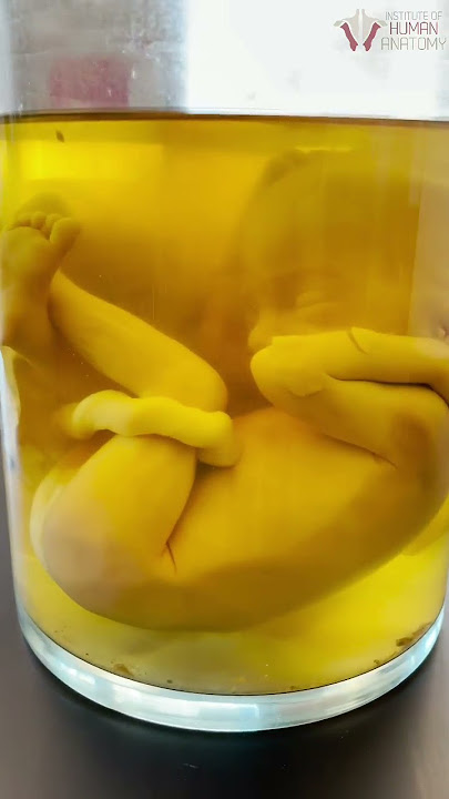 Amazing REAL Human Fetus That Taught Millions | #shorts