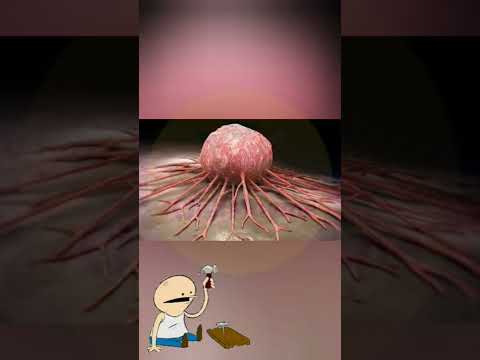 الذي عالج نفسه من السرطان بدون كيماوي أنت أيضا تستطيع 