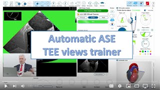 Famous Automatic ASE TEE Views Trainer Wealth