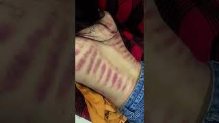 Download Lagu kerokan wanita masuk angin MP3 Download Lagu kerokan wanita masuk angin MP3