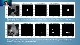 CT Airway Segmentation Using Cascaded 2D U-Net Neural Networks