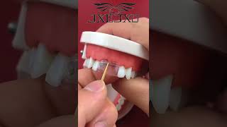 A good set of teeth fixed by modeal bead. dentist Tips😘😘 #🦷#bead#misstooth#repair#jxejxotooth