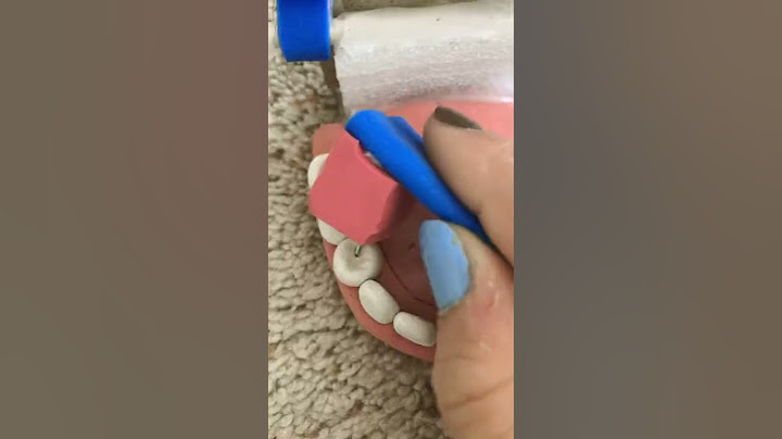 DIY dental set!! #shorts
