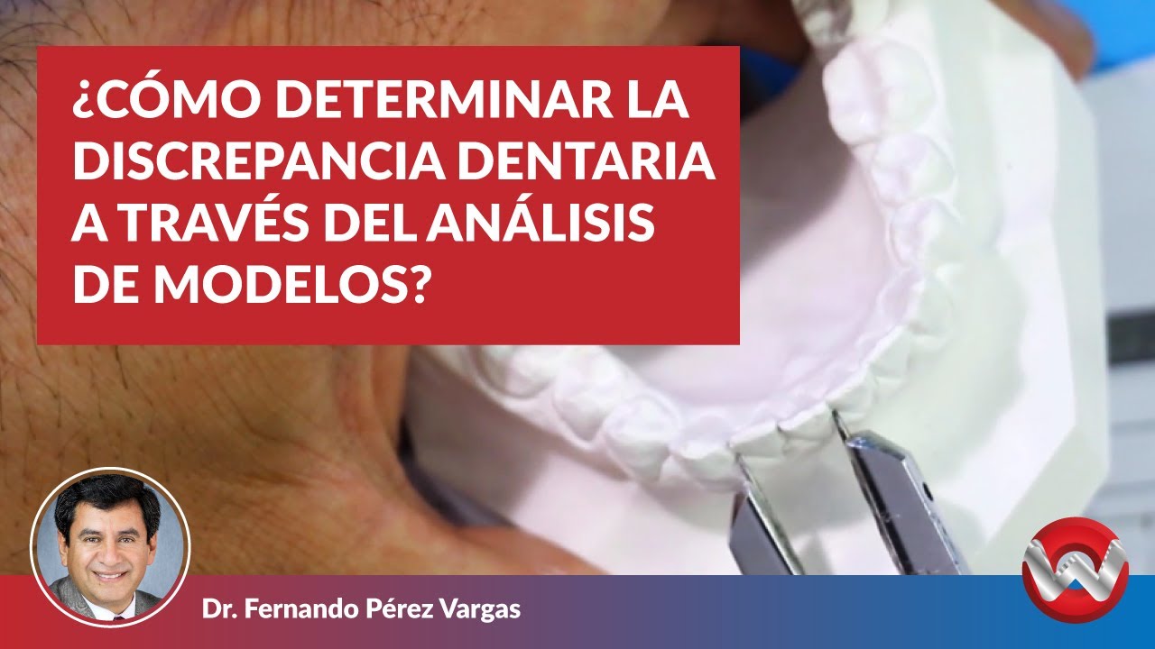 Cómo Determinar la Discrepancia Dentaria a través del Análisis de ...