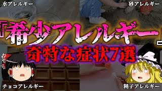 【ゆっくり解説】『珍しいアレルギー』を解説！アナフィラキシーの危険も…【雑学・医療系解説】『闇学』