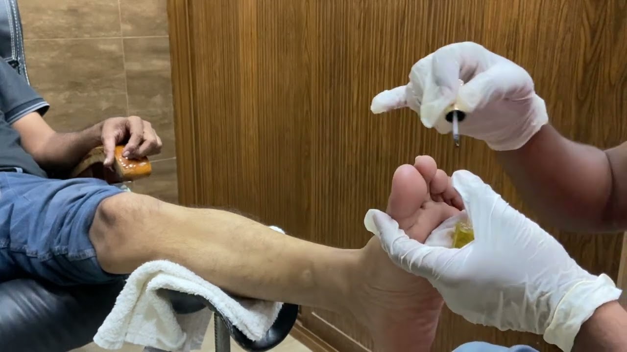 Foot Spa Paradise – A World of RelaxationExperience the Ultimate Comfort! Foot massage | Relaxing ✨🔥