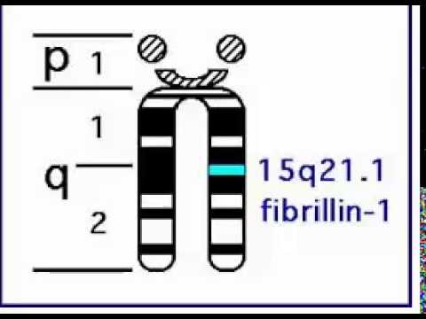 P 3 15 q 14 25. Ген fbn1. Ген фибриллин 1.