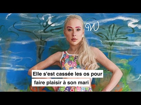 Elle s'est cassée les os pour faire plaisir à son mari 😱