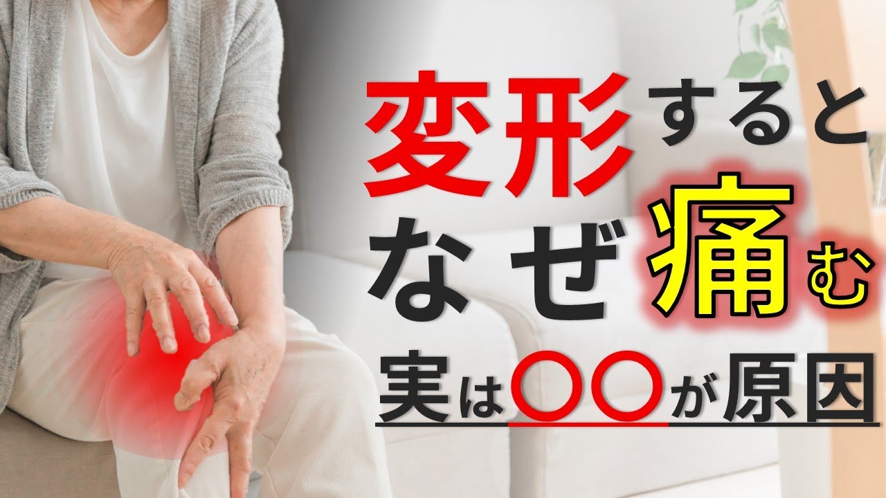 Knee osteoarthritis ③] Why does it hurt? Actually, it was caused