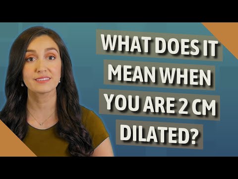 Video: Cosa significa quando sei dilatato di 2 cm?