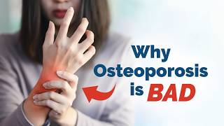 Why Osteoporosis is Bad