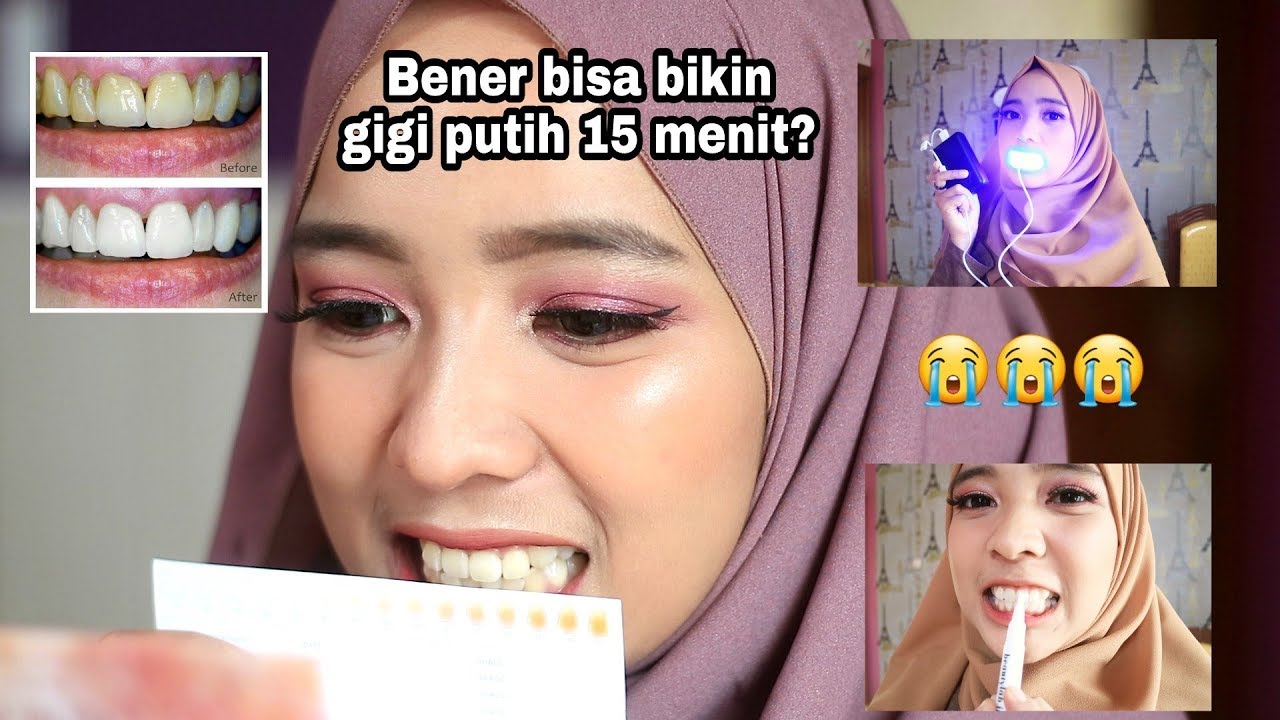 Cara Memutihkan Gigi Tanpa Harus Ke Dokter Gigi ! | Yuny Isnaini 