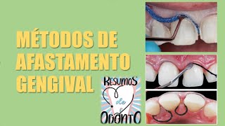 Métodos De Retração Gengival Resumos De Odonto