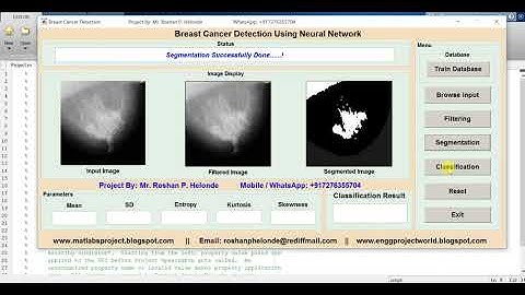 Breast Cancer Detection and Classification using Matlab Source Code