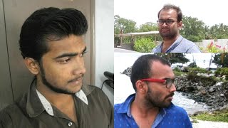 BALDING IN MY 20's IN INDIA 🇮🇳 Dealing With Balding As An Indian Man