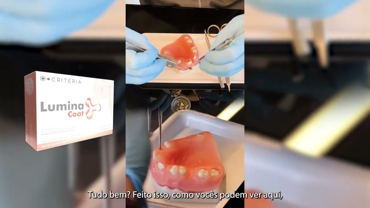 MANIPULAÇÃO EM MANEQUIM COM LUMINA COAT, COM DR. GUSTAVO MOMESSO