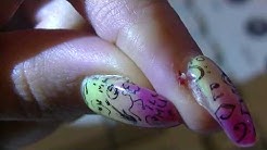 removing a hangnail (graphic)