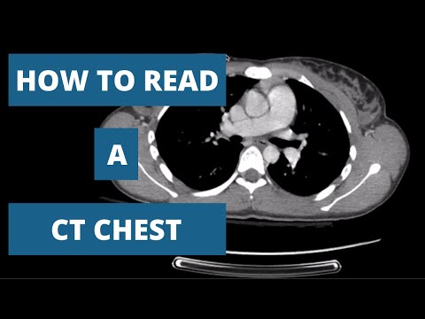 How to Read a CT Scan Chest - A Radiologists Approach