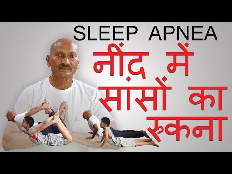 SLEEP APNEA (नींद में सांसों का रुक जाना) - 10 से 30 सेकंड तक रुक जाती है सांस । कारण और निवारण