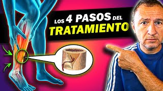 ⛔ ALERT: TIBIAL PERIOSTITIS! 💀 What is 'shin splints' and HOW TO CURE THEM