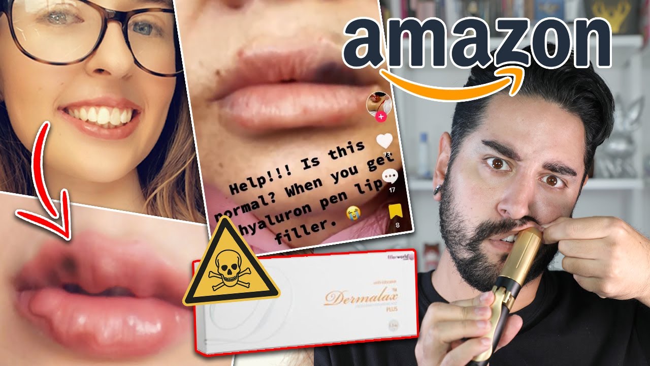 The DIY Filler Pen That Will Destroy Your Lips - The problem hyaluron pens - Beauty Turns Ugly - YouTube